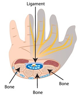 Carpal Tunnel Syndrome  Florida Orthopaedic Institute