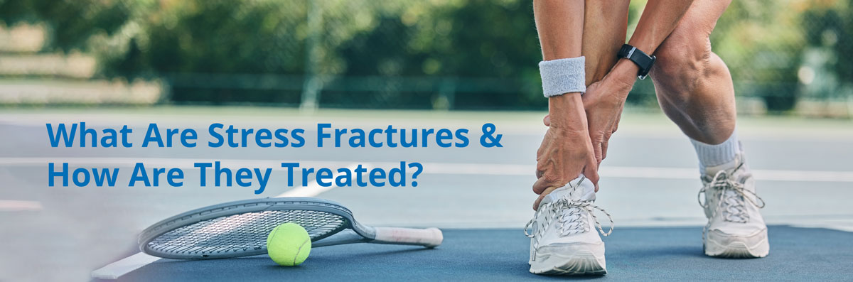 What Are Stress Fractures?